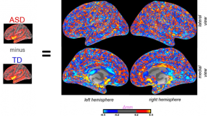 AUTISM BRAIN ORIGINS-ENVIRONMENT AND PHYSIOLOGY REALLY MATTER